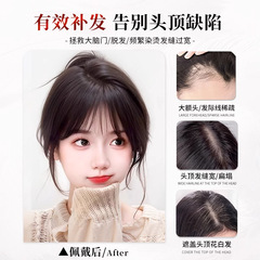 頭頂假劉海假髮女高顱頂蓬鬆增發量真發遮頭頂神器白髮補發假髮片
