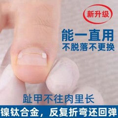 爪溝チタン合金直爪ステッカーワイヤーバックル巻き爪矯正バイオニック骨記憶合金巻き爪矯正装置セット