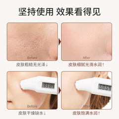 Water-derived hibiscus cream, hydrating, moisturizing and brightening skin, all-purpose facial cream, beauty salon same skin care product, water-derived cream wholesale