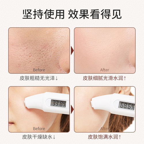 Water-derived hibiscus cream, hydrating, moisturizing and brightening skin, all-purpose facial cream, beauty salon same skin care product, water-derived cream wholesale