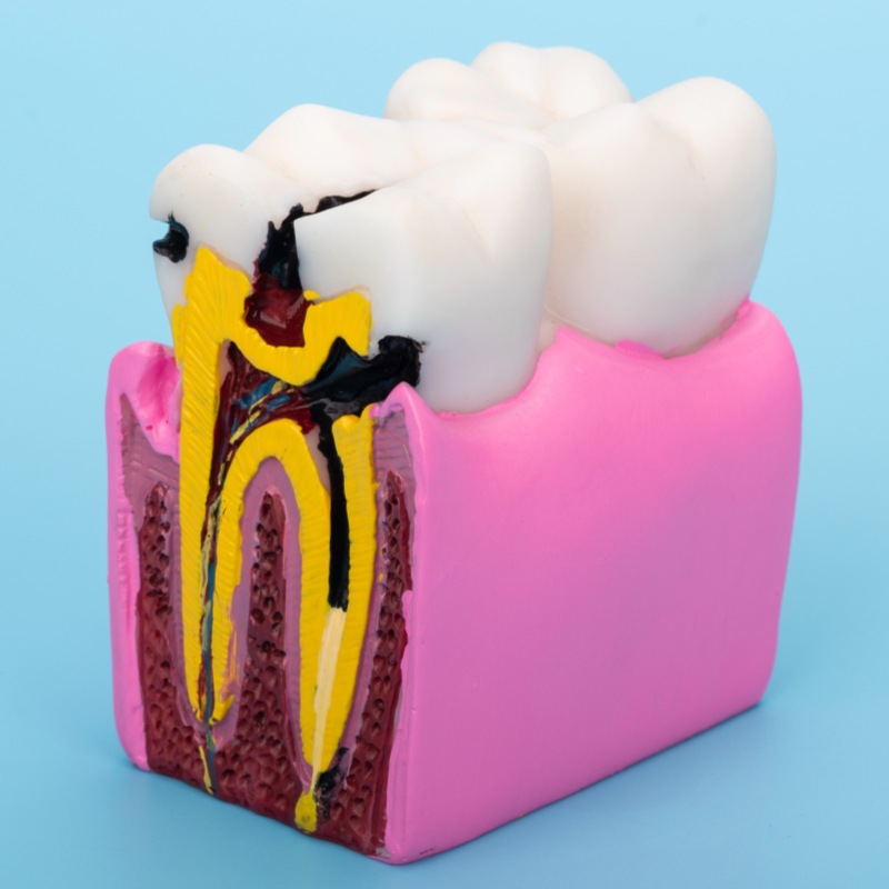 Oral Hospital Doctor-Patient Communication Teaching Model, Dental Bilateral Comparison Display, Denture Teaching Mold Ornaments