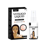 SUHU Оптовая продажа растворов для наружного применения (жидкость для покрытия небелых пятен, жидкость для белых пятен, потных пятен, белых пятен), травяная жидкость от производителя источника