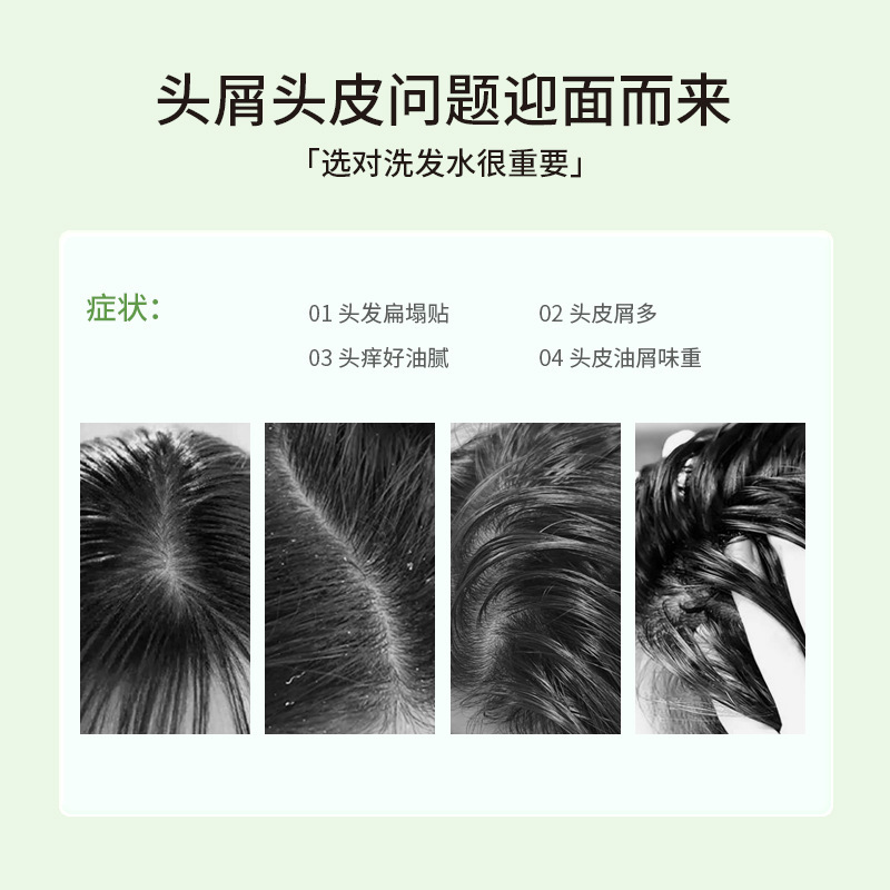 【屑取りかゆみ止め油】宜荘屑取りシャンプー二硫化セレン深層頭屑ケアふわふわ|undefined