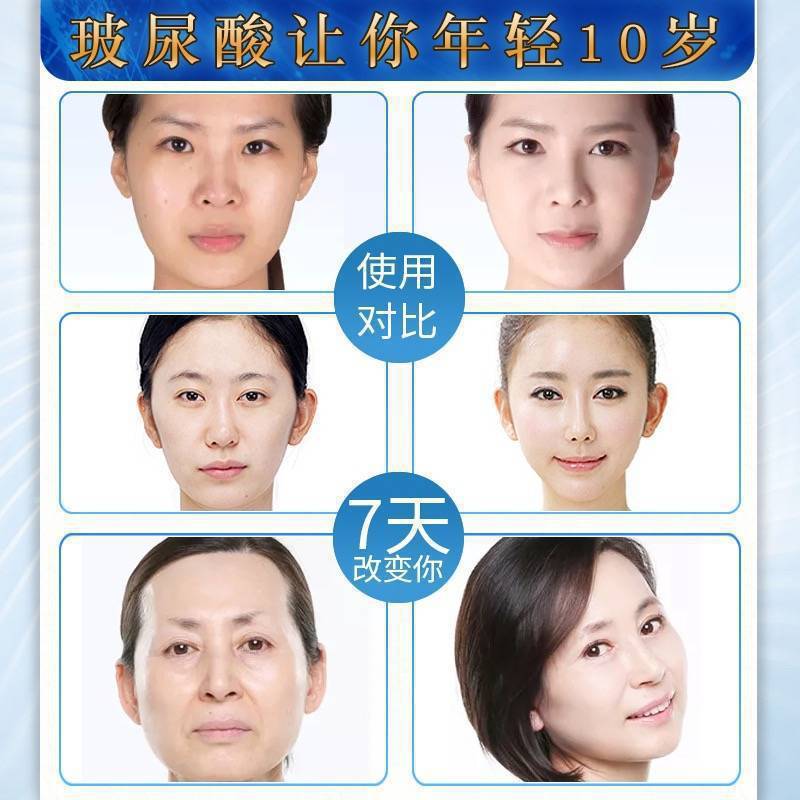 玻尿酸原液补水保湿淡化细小纹收缩毛孔透明质酸玻尿酸精华液批发|undefined