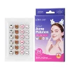 KORMESIC cute and interesting animal acne patches 24 capsules/box (cat + brown bear + piglet + rabbit) [cross-border sales only, domestic sales prohibited,
