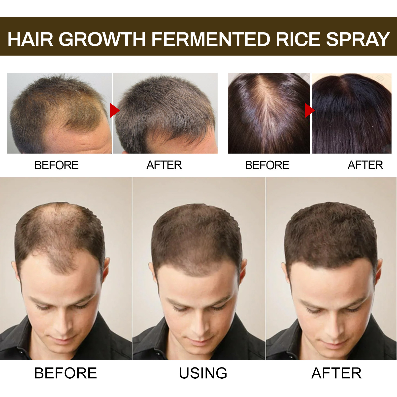 Jayswing dense spray keratin repair nourish root, prevent hair loss, and solid fermented rice_voghion.com