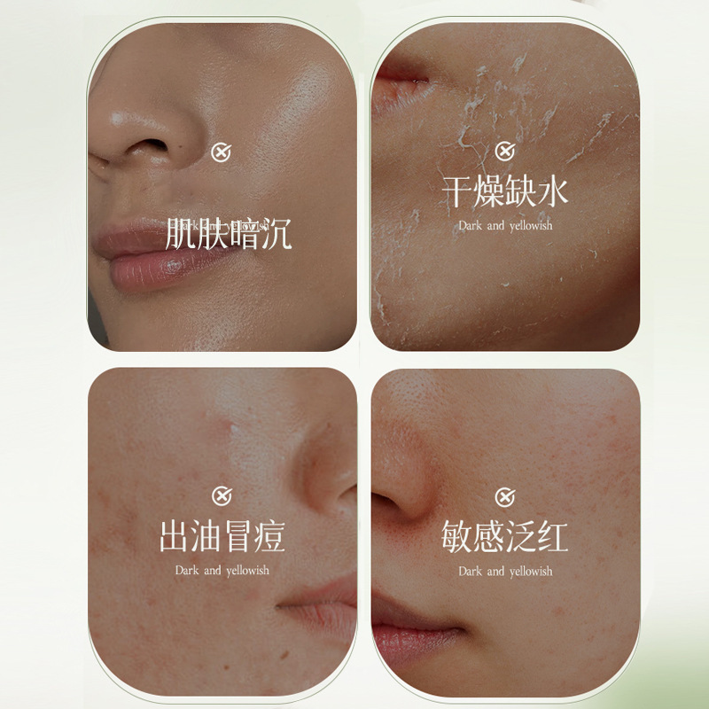 Auonam净妍控油收敛精华乳改善暗沉补水滋润嫩肤控油提亮肤色保湿|undefined