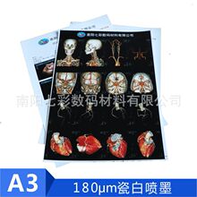 �t��A3�ɰ�Ѫ����Ӱ.θ�R����180&mu;m�׻���ī��ӡ�zƬ