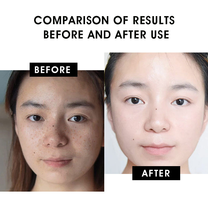 Vitamin C Serum Image 5