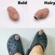 Cross-border explosions Big Toe Croc Charm funny creative hole shoes big toe shoe buckle with decoration