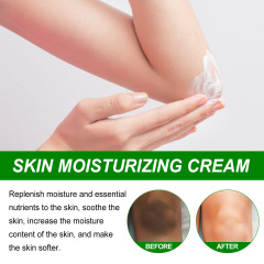 EELHOE Skin Beauty Cream Skin Brightening and Diminishing Melanin Joints Elbows and Armpits Moisturizing Skin Care Cream