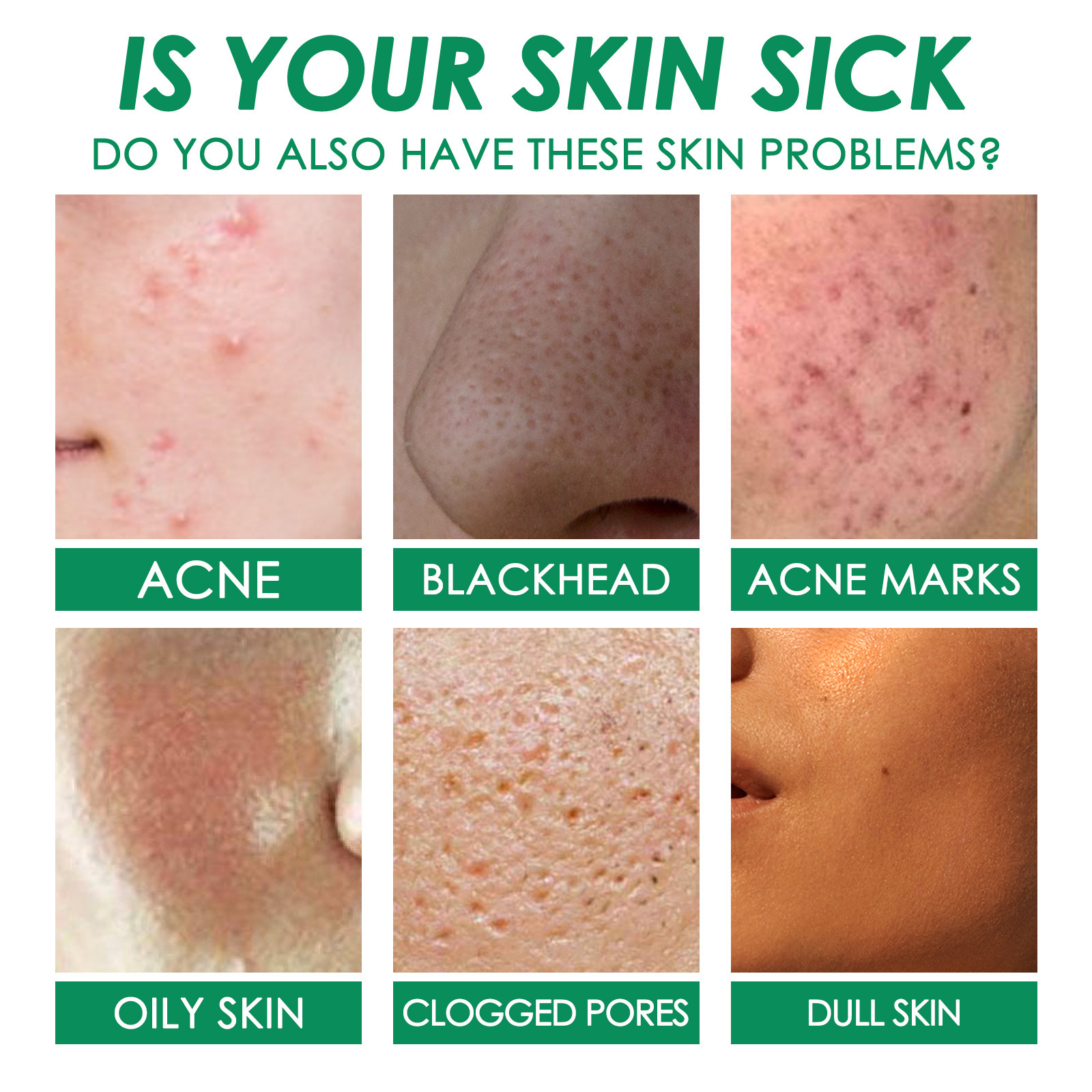 Téi OUHOE Gréng Vitamin Reinigungsmaske Gesiichtsakne Entfernt Déif Feuchtigkeitsspender Verschmierung Feinporenhaut_voghion.com