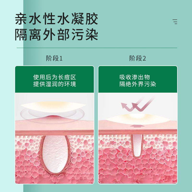 跨境新款壓邊痘痘貼 隱形遮瑕祛痘貼 輕薄透氣吸膿吸液粉刺貼