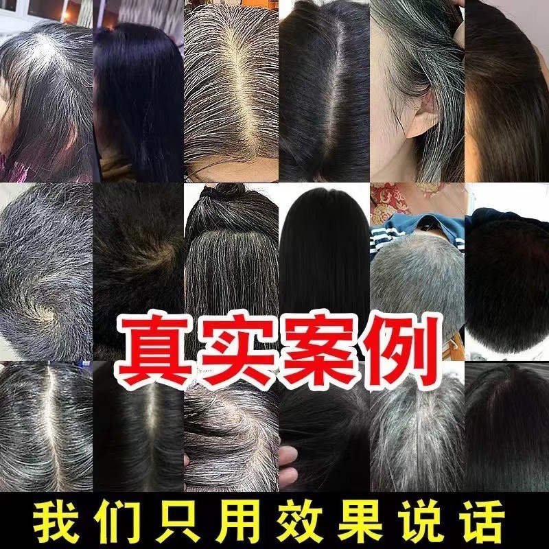 何首烏白転黒精華液白髪転黒髪栄養液滋養毛包養髪保護脱育毛液|undefined