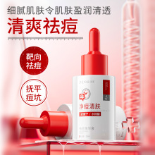��������AҺƤ�������ӡ���]�ڷ۴̰���ˮ�����տsë��ԭҺ