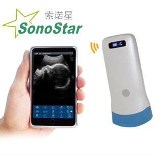 Sonostar���Z�� ���Q���� ͹ꇸ����ڰןo������B��̽�^ ԃ�Ά��r