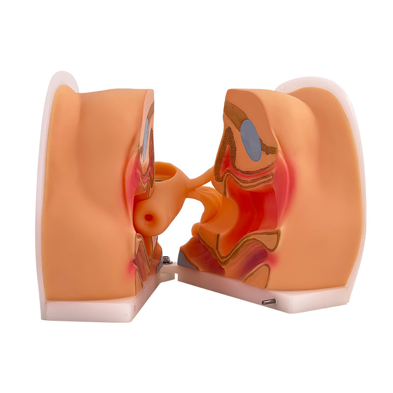 Ů����ֳ��ģ�� �����ӹ��������ѳ� ���Ƽ����н�ѧѵ�� 1��1