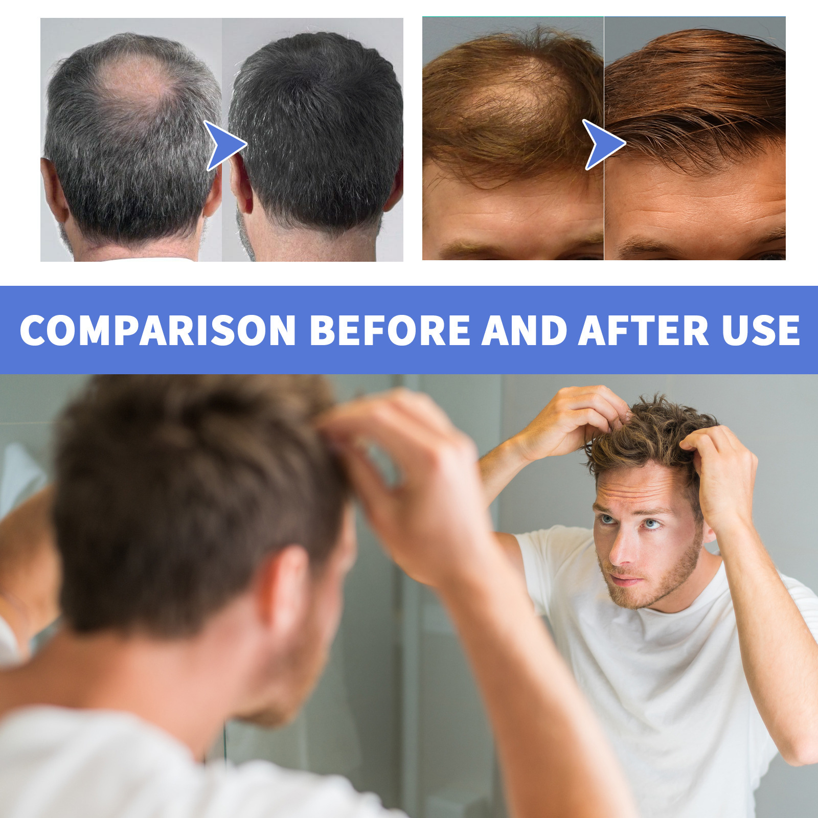 αφρός OUHOE Ανδρική μους Βαθύς Καθαρισμός Επανορθωτική Σύσφιξη Θυλακίων Ρίζας και Ενυδατική Περιποίηση Πυκνών Μαλλιών_voghion.com