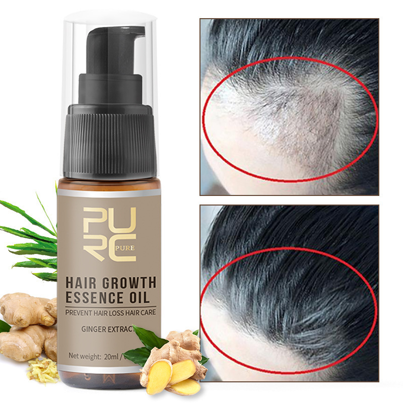 PURC Medical revitalizing spray with ginger