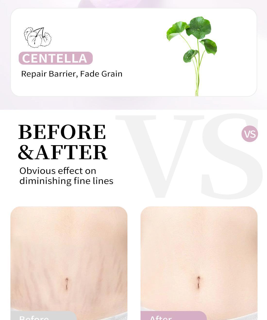 Crema reparadora de estrías para cuello COBEN_voghion.com