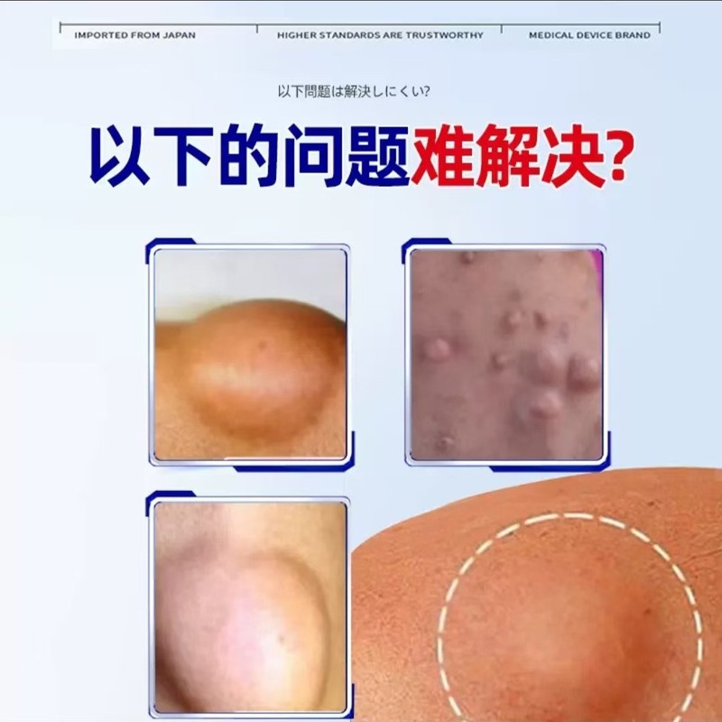【公式正規品】Baoyuan Pharmaceutical 遠赤外線治療ジェルプラットフォーム人気のドロップシッピングとアフターサービスの心配なし|undefined