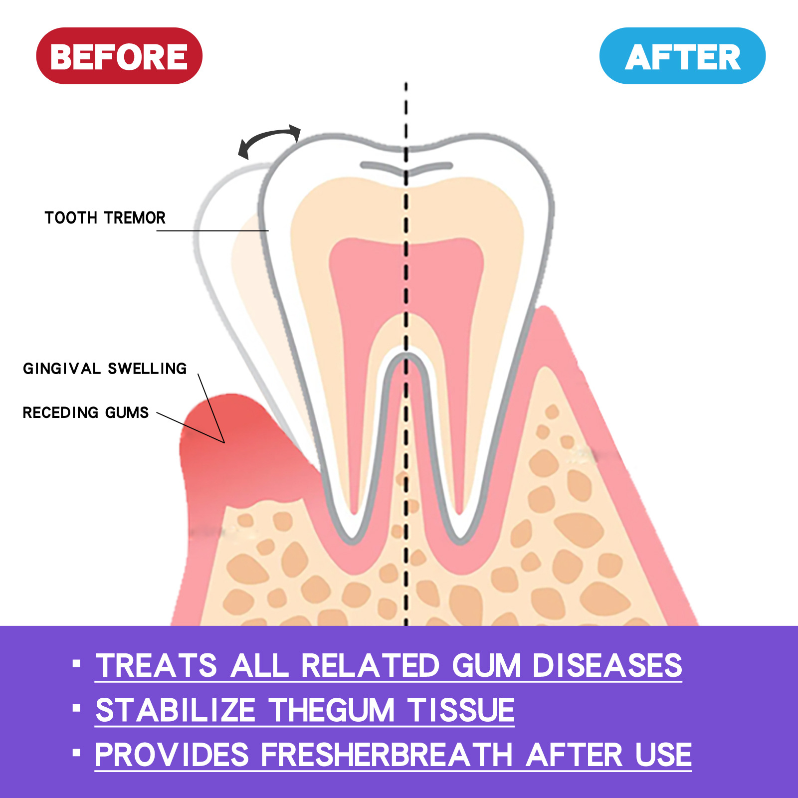 La mousse in schiuma di gomma EELHOE si prende cura delle gengive, pulisce in profondità i denti e lo sporco, pulisce i denti e protegge il dentifricio in mousse_voghion.com