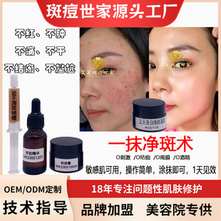 Upgrade freckle removal cream whitening hydrating sensitive skin special sleep mask freehand freckle removal fried freckle cream gel
