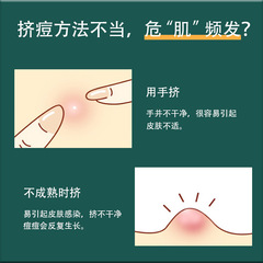 廠家不鏽鋼粉刺針4件套 玫瑰金痘痘針去黑頭暗瘡針祛痘針美容工具