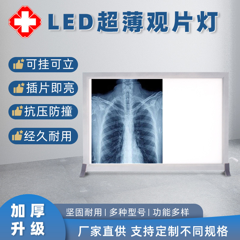 厂家现货单双联LED观片灯片X光胶片观片灯 超薄阅片灯CT看片灯