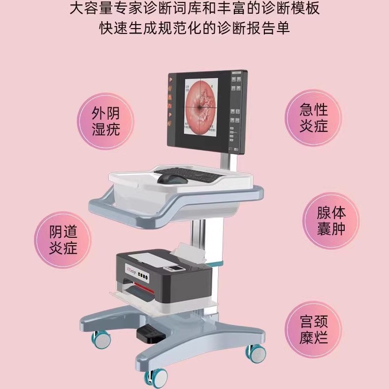 Colposcopio médico de alta definición endoscopio cervical vaginal colposcopio electrónico digital instrumento ginecológico de píxeles de alta definición