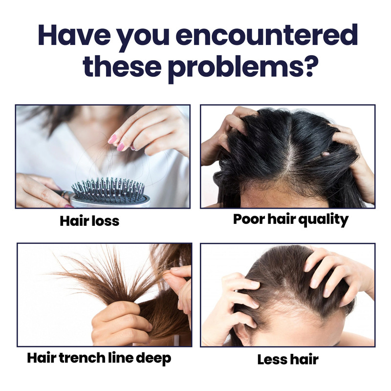 OUHOEヘアケアスプレー強靭な髪は潤いがあります。|undefined