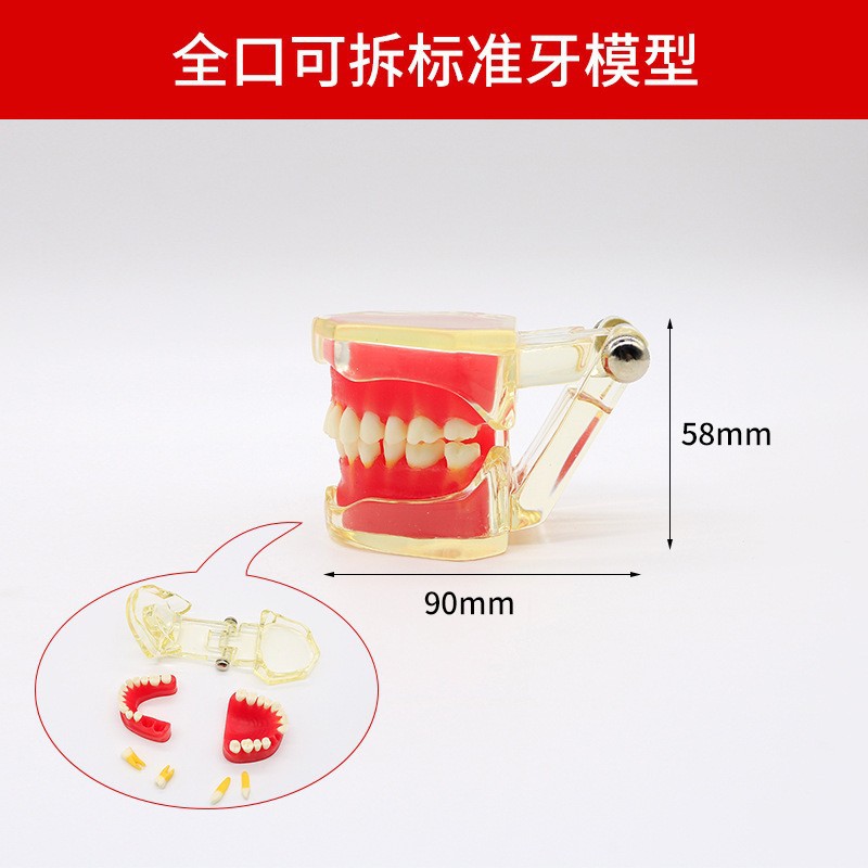 Modelo de ortodoncia dental semi-metal semibrackets Práctica de corrección de molde dental estándar Comunicación médico-paciente Modelo de enseñanza Modelo dental