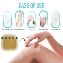 �羳����ˮ�z�w�������Ղ��ڝBҺ�t�÷��N�˹�Ƥ�N�����N