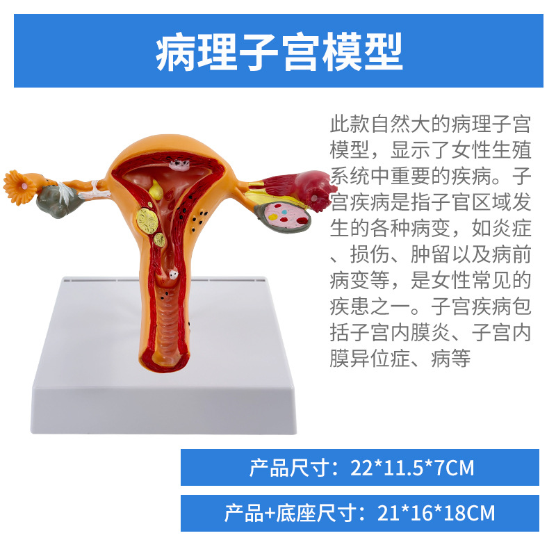 ҽѧŮ���ӹ�ģ���ѳ���ֳ�ṹ����ģ�͸��Ƹ������ѳ��ӹ�ģ��