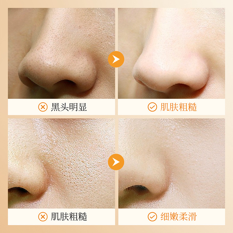Nutritious night face mask, vitamin C, skin rejuvenation, easy application