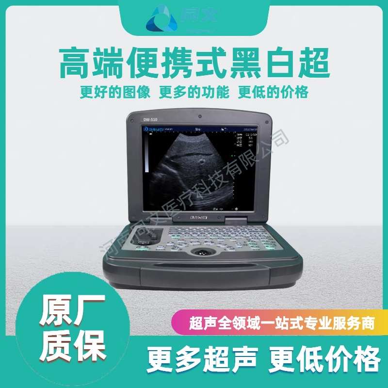Ultrasonido portátil en blanco y negro Ultrasonido B portátil Ultrasonido B clínica de base Ultrasonido médico en blanco y negro