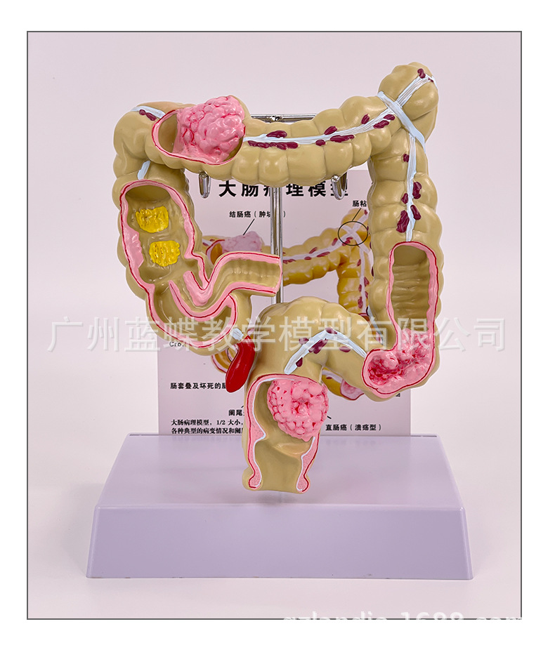 ��ѧ����᳦����ģ�ʹ�ֱ������걾����ҽ����ͨ�������ٽ���