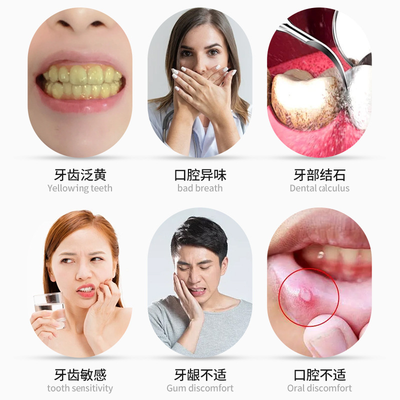 歯石嗽水吉雅藤耐牌嗽水が口腔歯石口の異臭を和らげる健康液|undefined