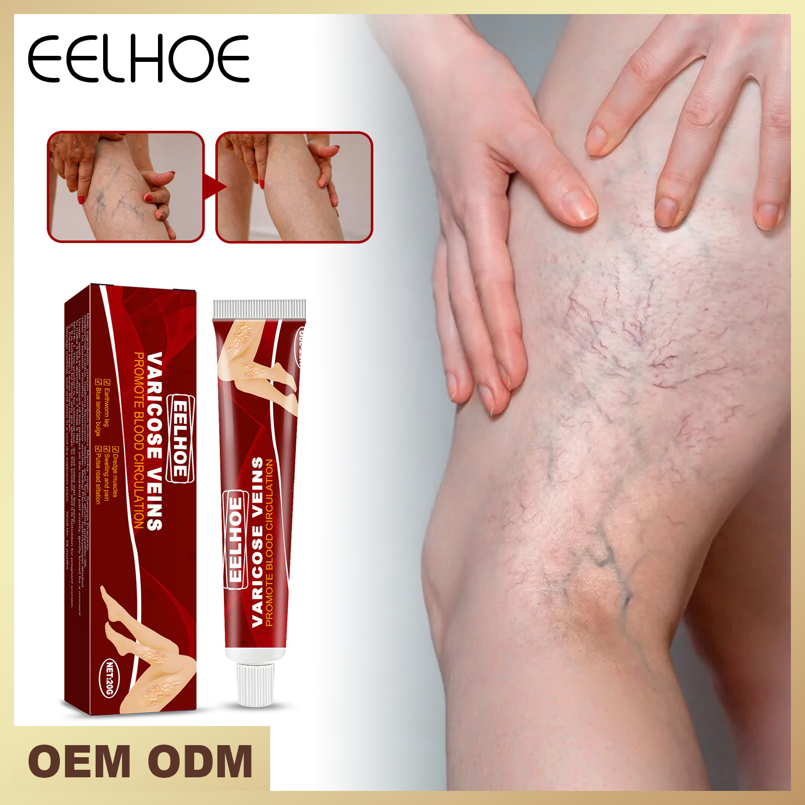 eelhoe vein massage varicose cream relie...