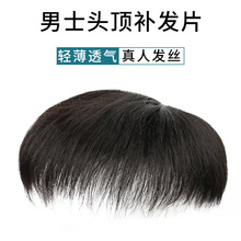 男士假发真人补头顶发假发片仿递针旋逼真遮白发发块补发片短发