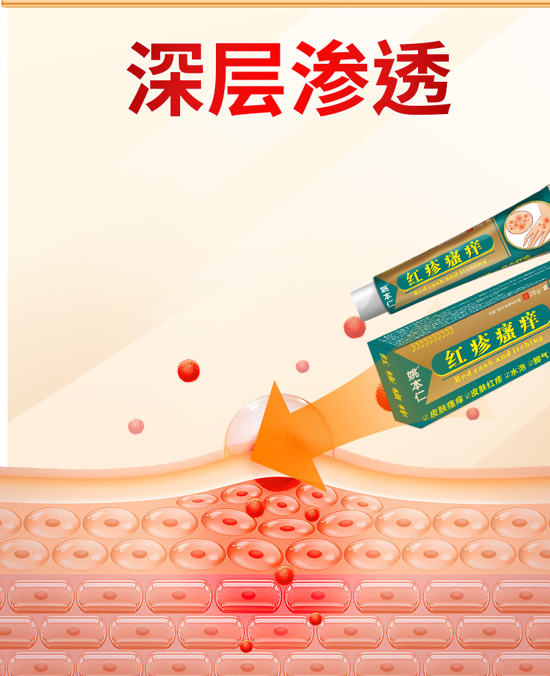 Yao Benren Skin External Discomfort Ointment Cream for Itchy Red Swollen Skin 20g in use