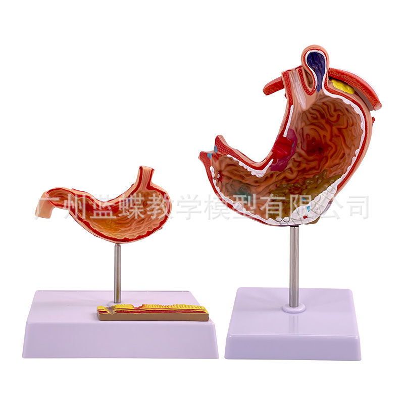 ����θģ�� ����θ�Ĵ��� ��̬θģ�� ������ θ��״������ʷŴ�