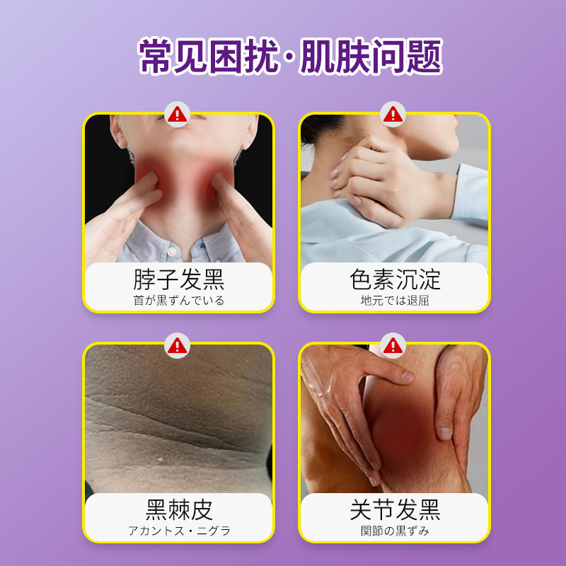 吉雅藤耐黒棘皮ペースト30g皮膚不快首関節黒ずみ黒棘皮ペーストメーカー卸売り|undefined