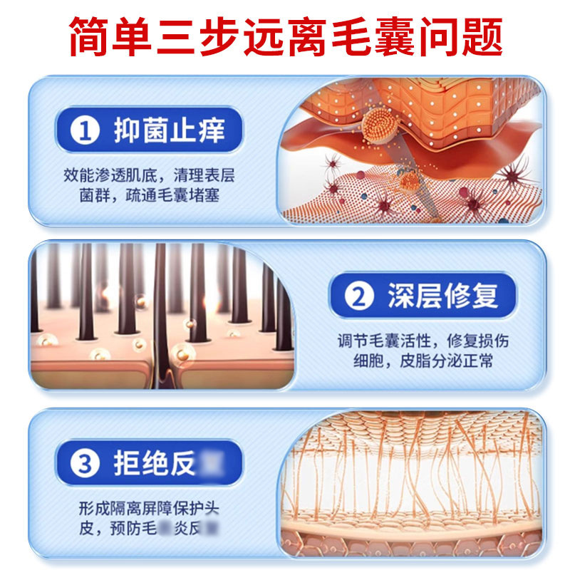 タイワンブルー 毛包ヘルスケアクリーム 毛包詰まりクリーム 頭皮ニキビ 皮膚かゆみ止めクリーム 皮膚炎クリーム 30g|undefined