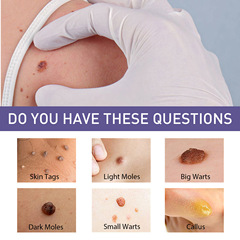 OUHOE 克疣軟膏 清潔手足臉部皮膚肉粒克疣護理膏滋潤平滑肌膚