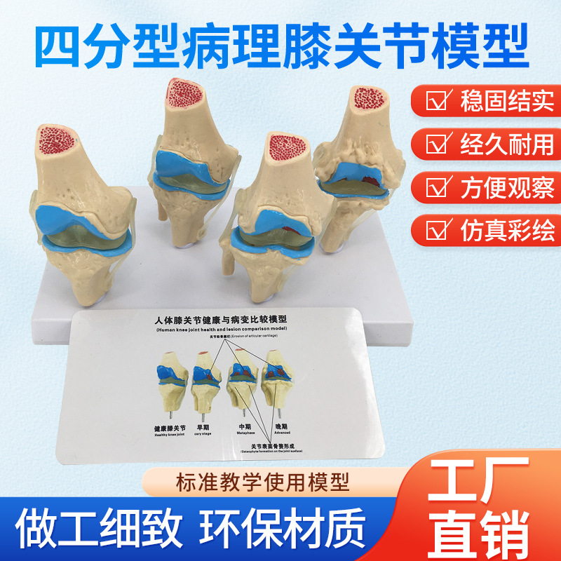 ��̬ ϥ�ؽ�ģ�� �Ľ׶β���ϥ�ؽ�ģ�� ���� ����ϥ�ؽ�ģ��