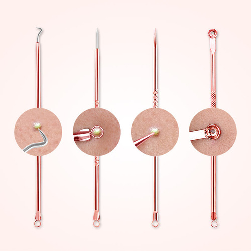 Rose gold 4-piece acne needle set, acne needle stainless steel blackhead tool, acne needle four-piece set cross-border seller