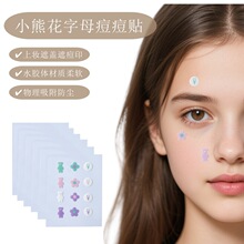 �羳��ͨ�ɐۮ��ζ����NС�ܻ���ĸˮ�z�w�����N�ϊy���w��覱�y