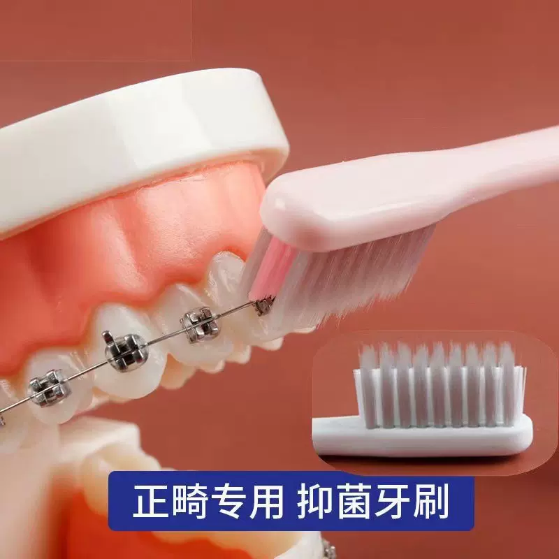 U型正畸牙刷口腔牙齿软细毛牙套矫正器专用清洁箍牙缝牙膏软毛