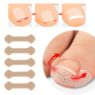 Nail Patches, Foot Patches, Ingrown Toenails, Toenail Pads, Manicure Patches